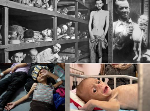 Vítimas severamente desnutridas em diferentes contextos históricos